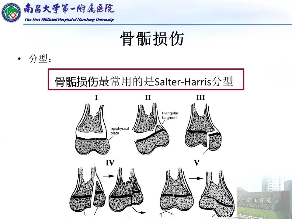 影像PPT - 【PPT】儿童肘关节骨折X线诊断-24