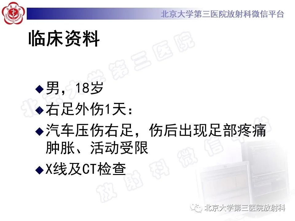 影像PPT - 【PPT】Lisfranc损伤-2