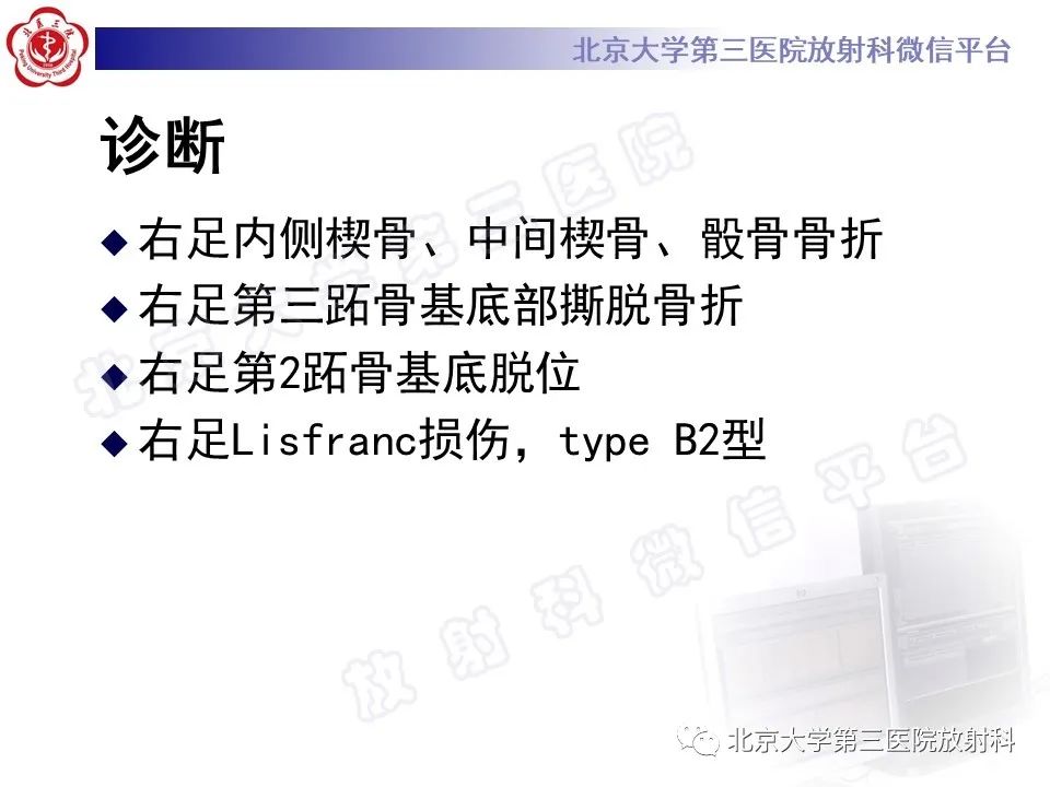 影像PPT - 【PPT】Lisfranc损伤-10