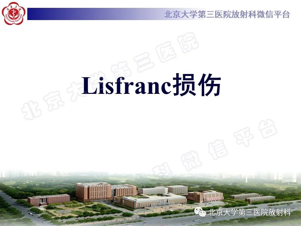 影像PPT - 【PPT】Lisfranc损伤-12