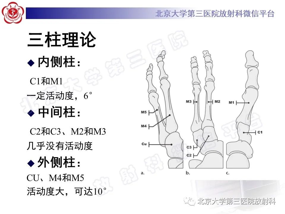 影像PPT - 【PPT】Lisfranc损伤-15