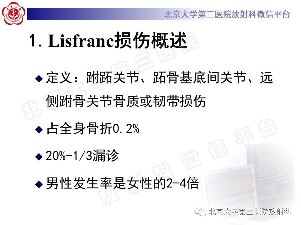 影像PPT - 【PPT】Lisfranc损伤-20
