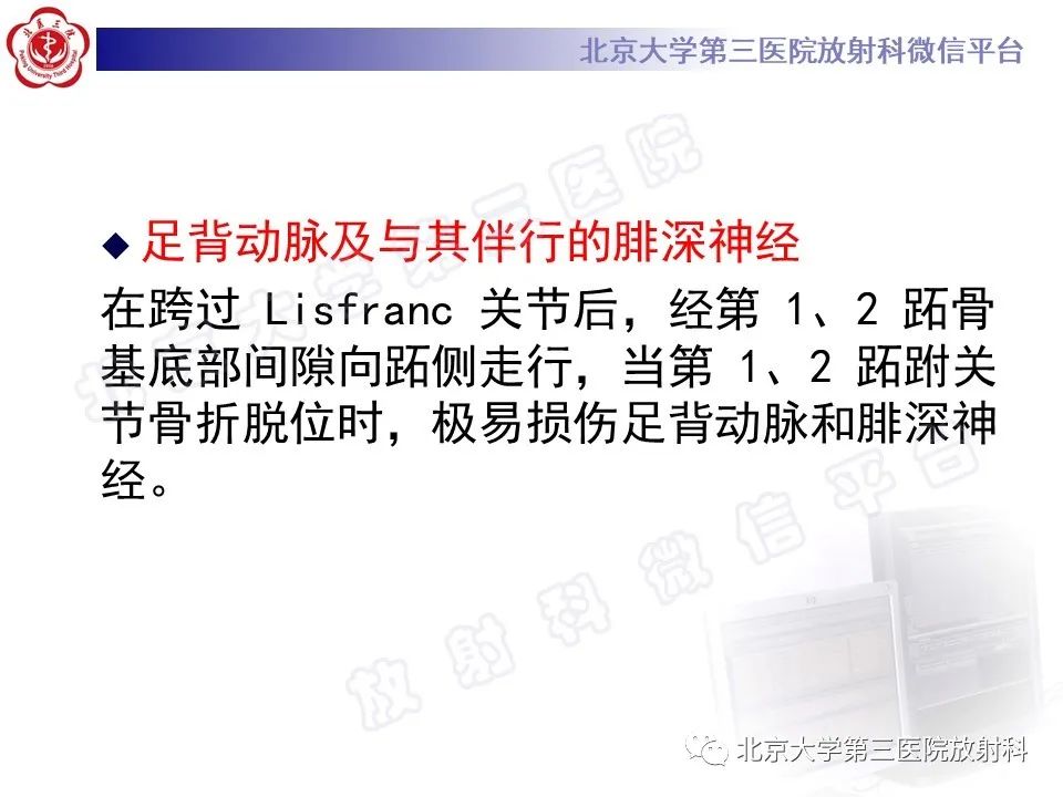 影像PPT - 【PPT】Lisfranc损伤-19