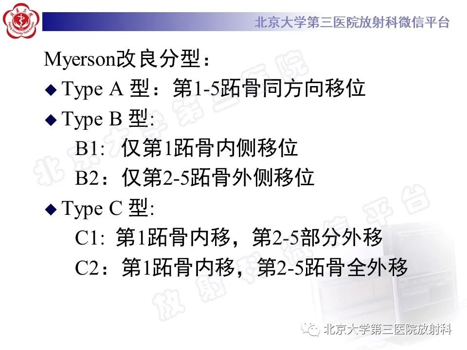 影像PPT - 【PPT】Lisfranc损伤-24