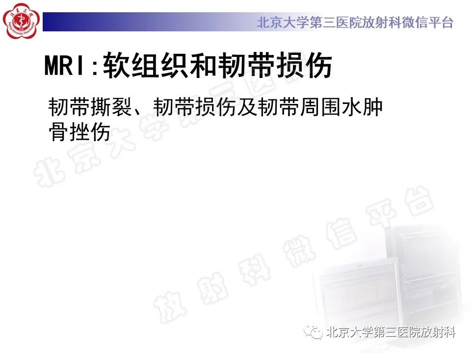影像PPT - 【PPT】Lisfranc损伤-37
