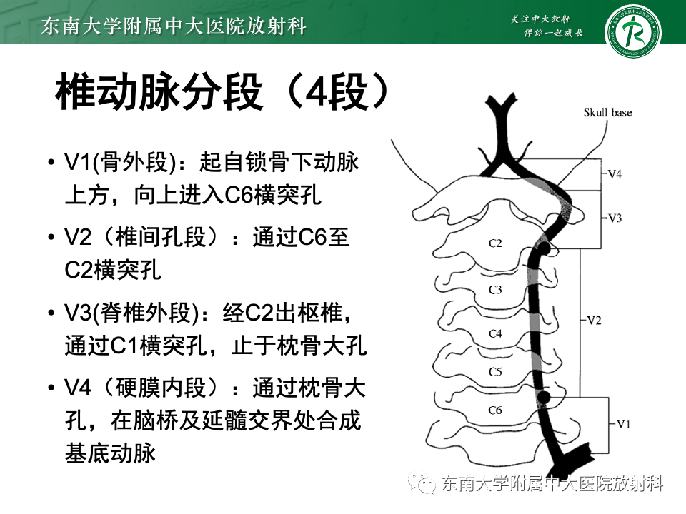 影像PPT - 【PPT】永存颈内—基底动脉吻合-11