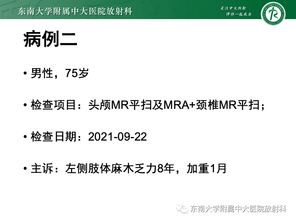 影像PPT - 【PPT】永存颈内—基底动脉吻合-33