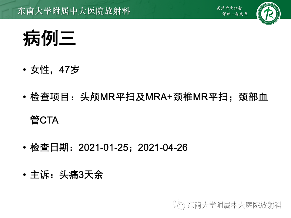 影像PPT - 【PPT】永存颈内—基底动脉吻合-43