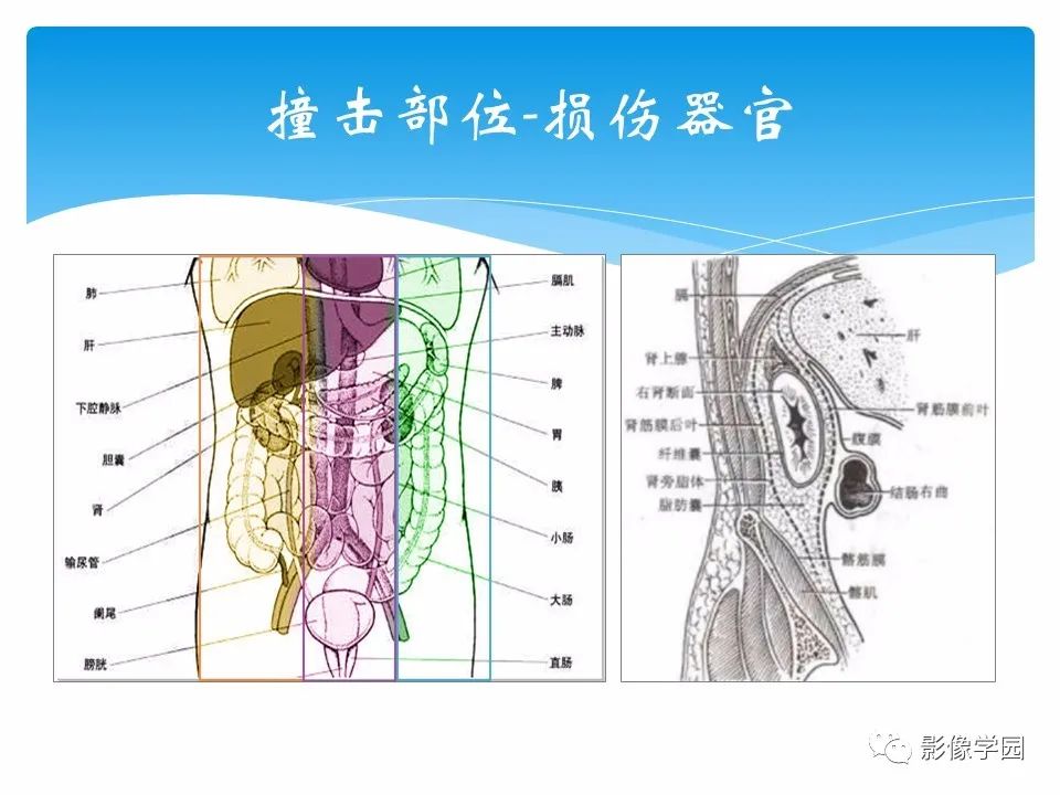 影像PPT - 【PPT】常见腹部外伤的影像诊断-10