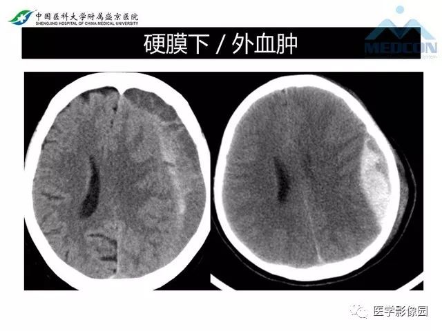 影像PPT - 【PPT】放射科危急值的处理-19
