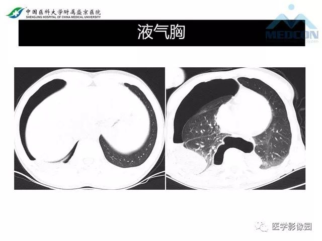 影像PPT - 【PPT】放射科危急值的处理-20
