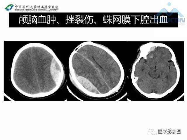 影像PPT - 【PPT】放射科危急值的处理-18
