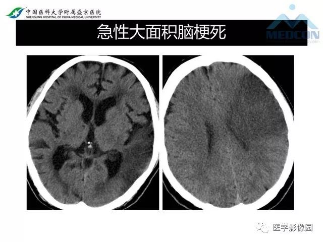 影像PPT - 【PPT】放射科危急值的处理-22