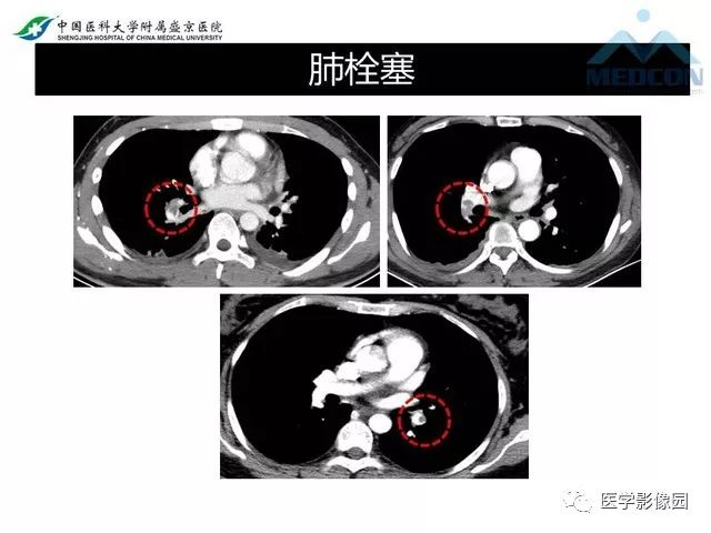 影像PPT - 【PPT】放射科危急值的处理-23