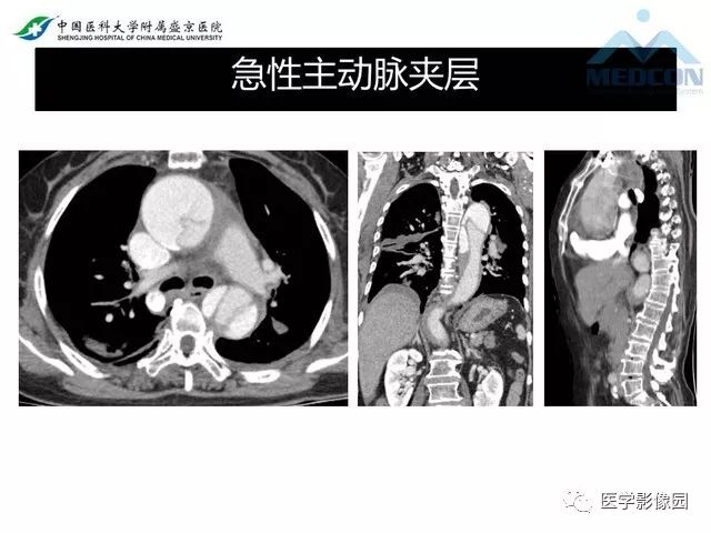 影像PPT - 【PPT】放射科危急值的处理-24