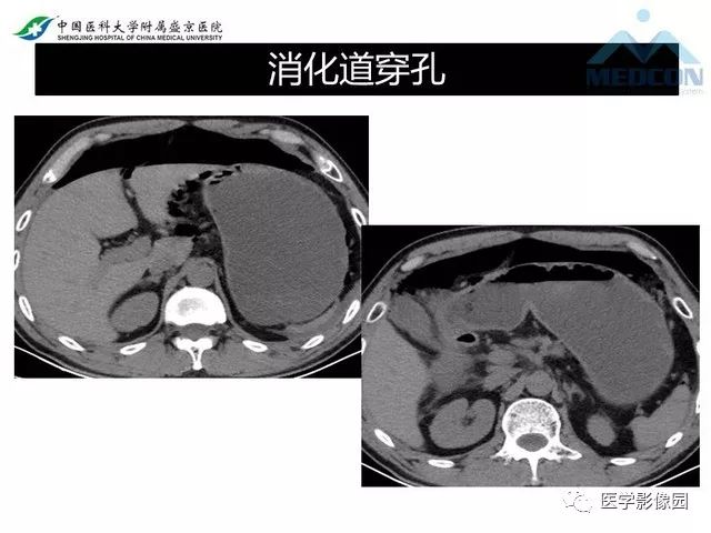 影像PPT - 【PPT】放射科危急值的处理-25