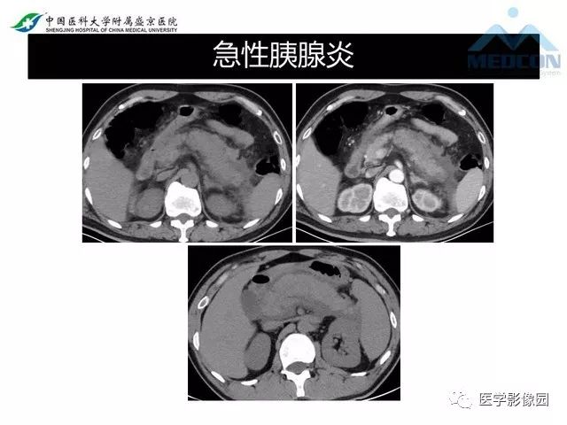 影像PPT - 【PPT】放射科危急值的处理-26