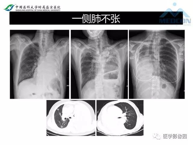 影像PPT - 【PPT】放射科危急值的处理-29
