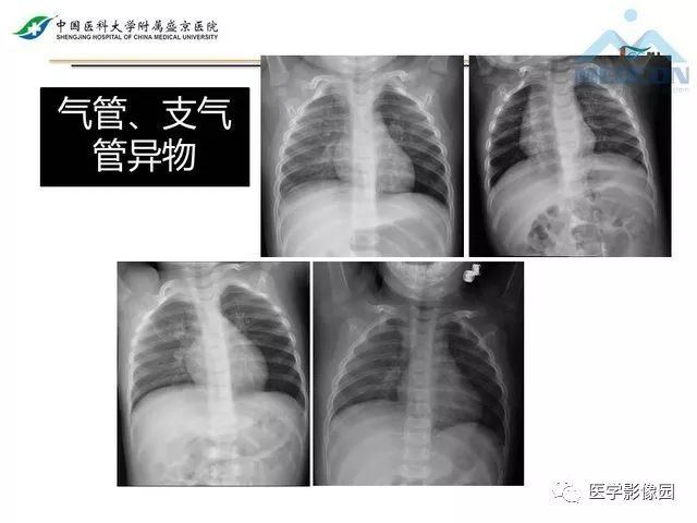 影像PPT - 【PPT】放射科危急值的处理-30