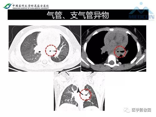 影像PPT - 【PPT】放射科危急值的处理-31