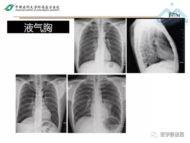 影像PPT - 【PPT】放射科危急值的处理-32