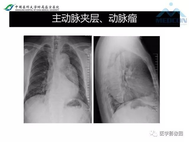 影像PPT - 【PPT】放射科危急值的处理-33