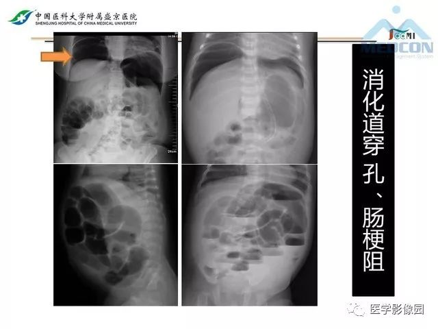影像PPT - 【PPT】放射科危急值的处理-34