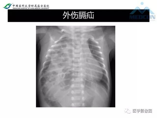 影像PPT - 【PPT】放射科危急值的处理-35