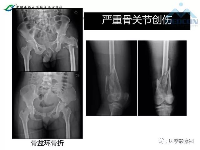 影像PPT - 【PPT】放射科危急值的处理-36