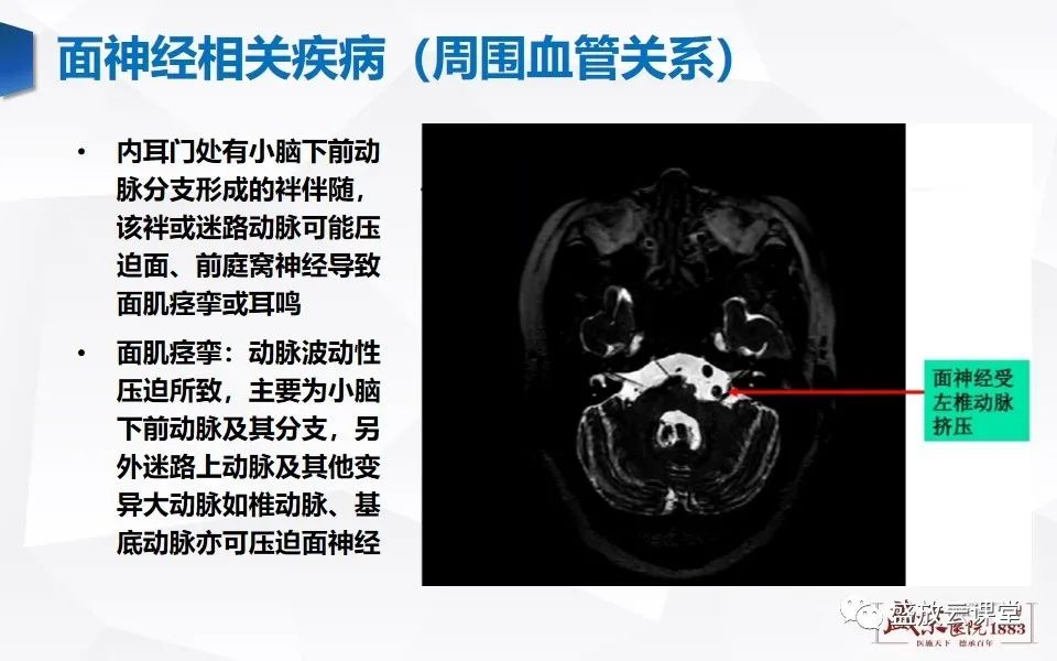 影像PPT - 【PPT】面神经MR评估-12