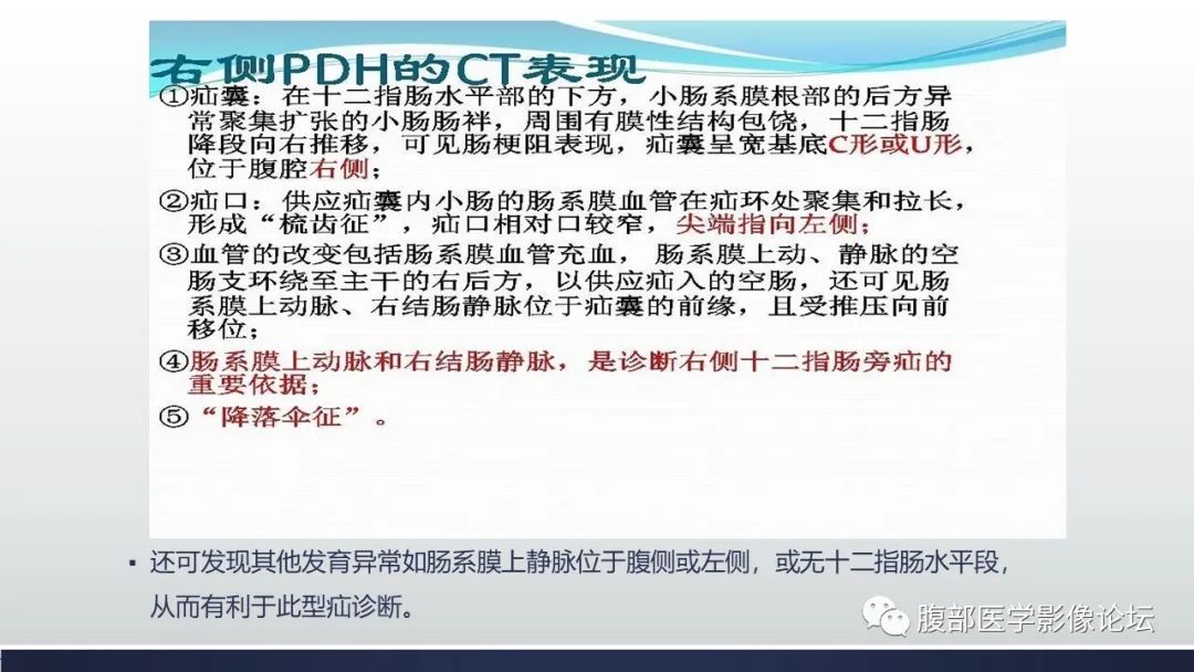 影像PPT - 【病例】腹内疝—小网膜囊疝1例CT影像-30 影像PPT - 【病例】腹内疝—小网膜囊疝1例CT影像-30