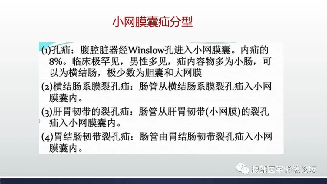 影像PPT - 【病例】腹内疝—小网膜囊疝1例CT影像-38 影像PPT - 【病例】腹内疝—小网膜囊疝1例CT影像-38