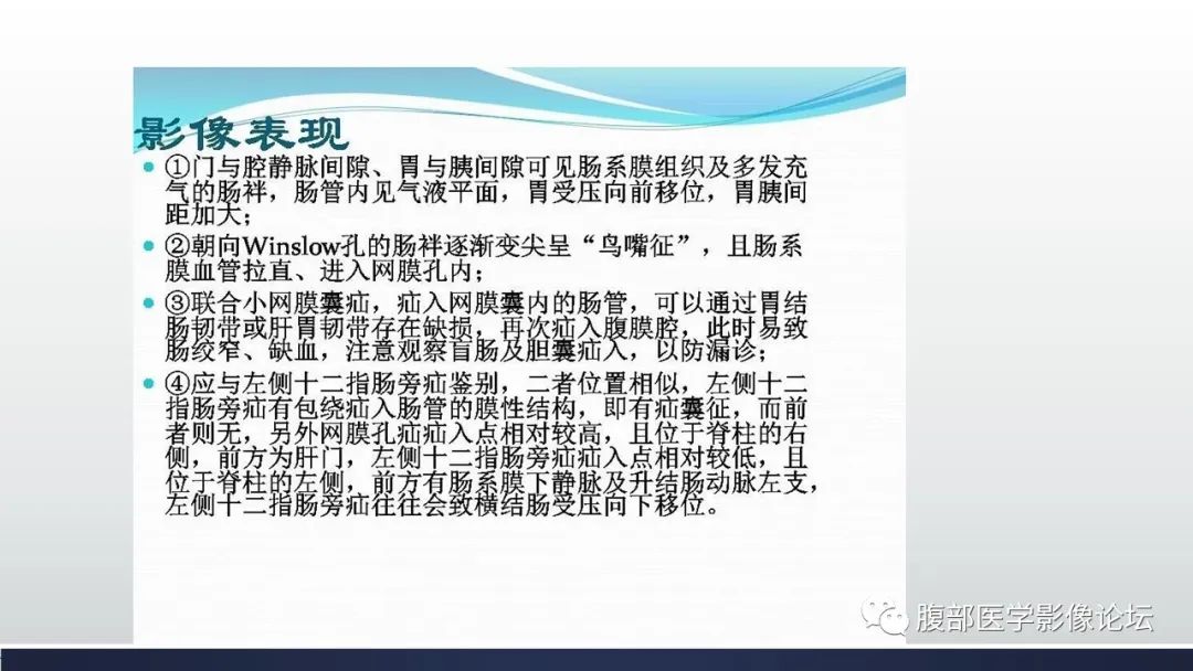 影像PPT - 【病例】腹内疝—小网膜囊疝1例CT影像-41 影像PPT - 【病例】腹内疝—小网膜囊疝1例CT影像-41