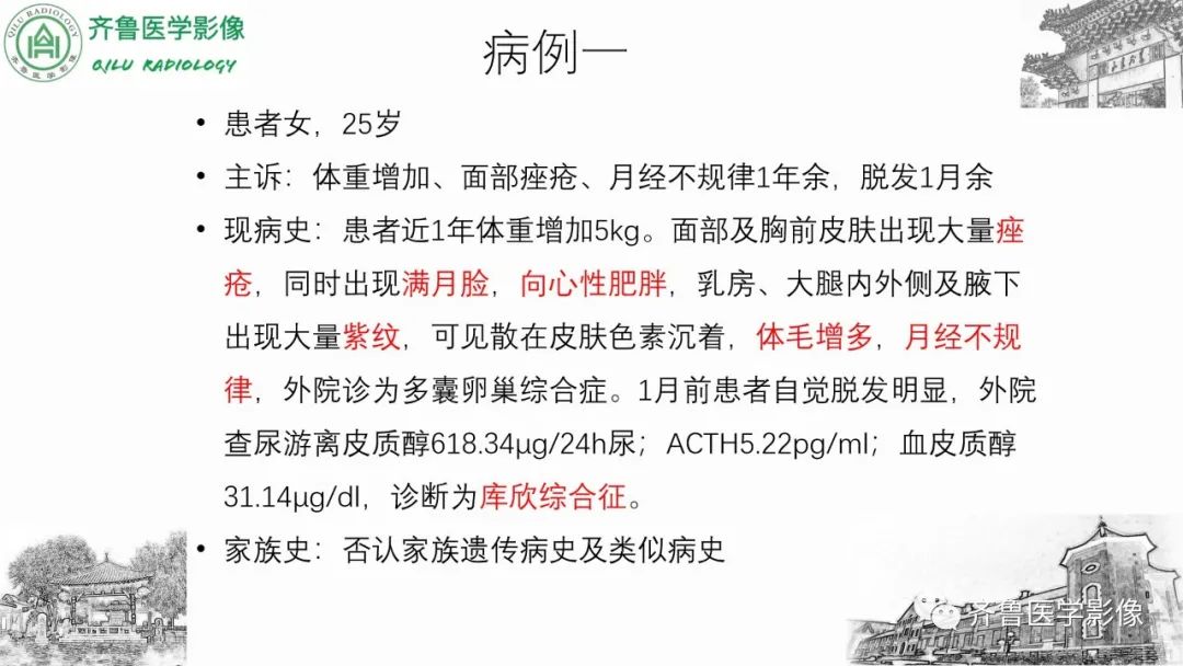 影像PPT - 【病例】肾上腺皮质腺癌2例CT及MR影像-2