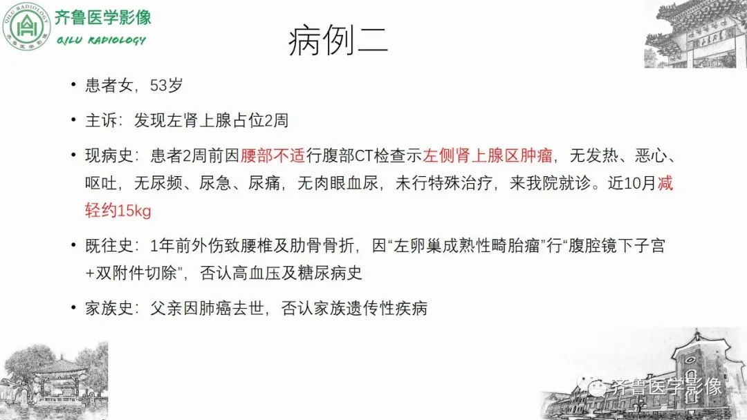 影像PPT - 【病例】肾上腺皮质腺癌2例CT及MR影像-9