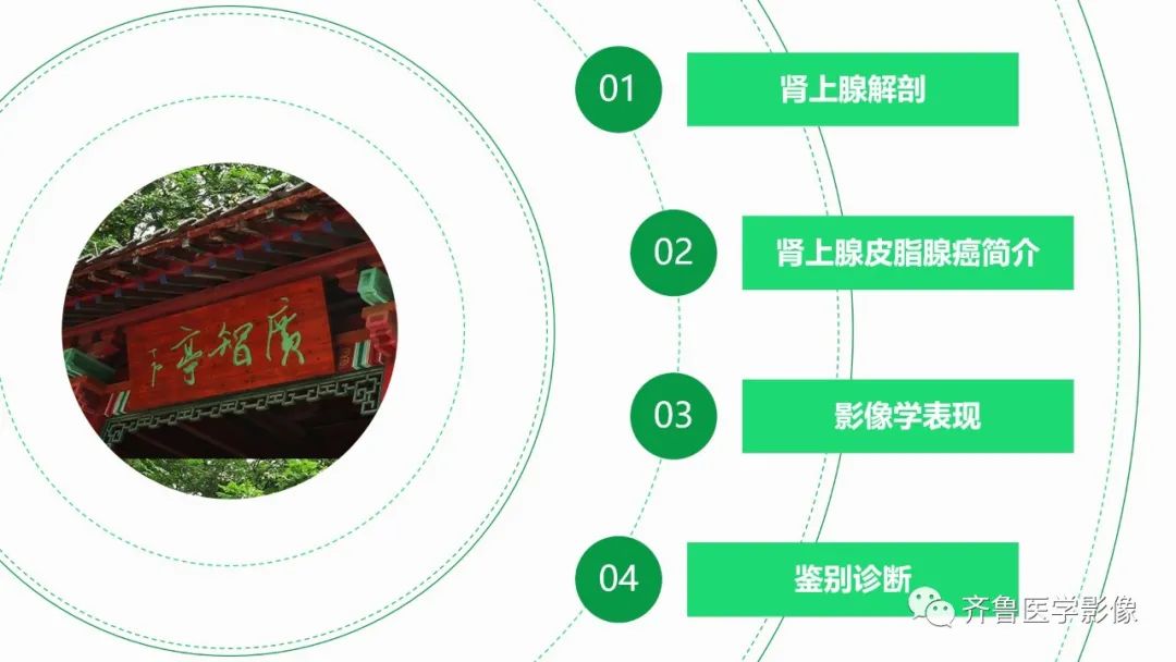 影像PPT - 【病例】肾上腺皮质腺癌2例CT及MR影像-18