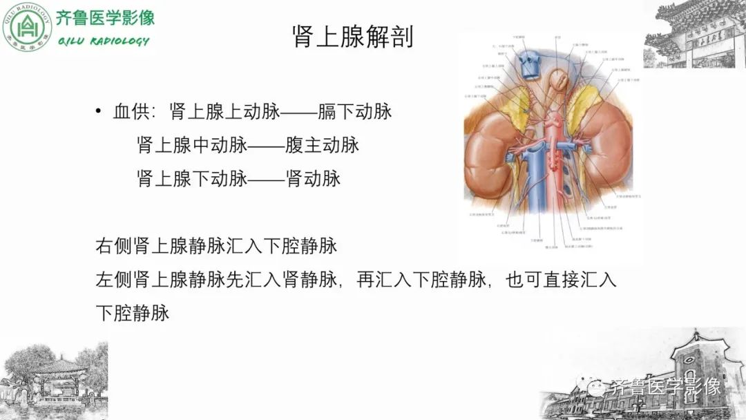 影像PPT - 【病例】肾上腺皮质腺癌2例CT及MR影像-20