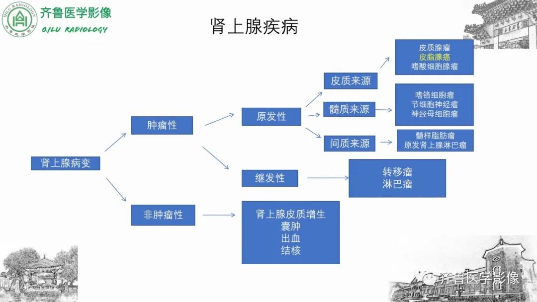 影像PPT - 【病例】肾上腺皮质腺癌2例CT及MR影像-22