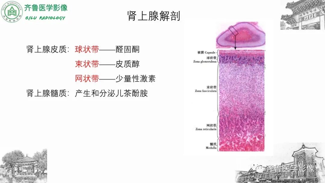 影像PPT - 【病例】肾上腺皮质腺癌2例CT及MR影像-21