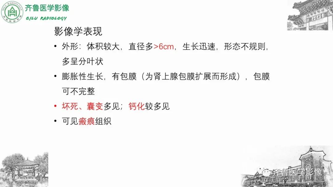 影像PPT - 【病例】肾上腺皮质腺癌2例CT及MR影像-24