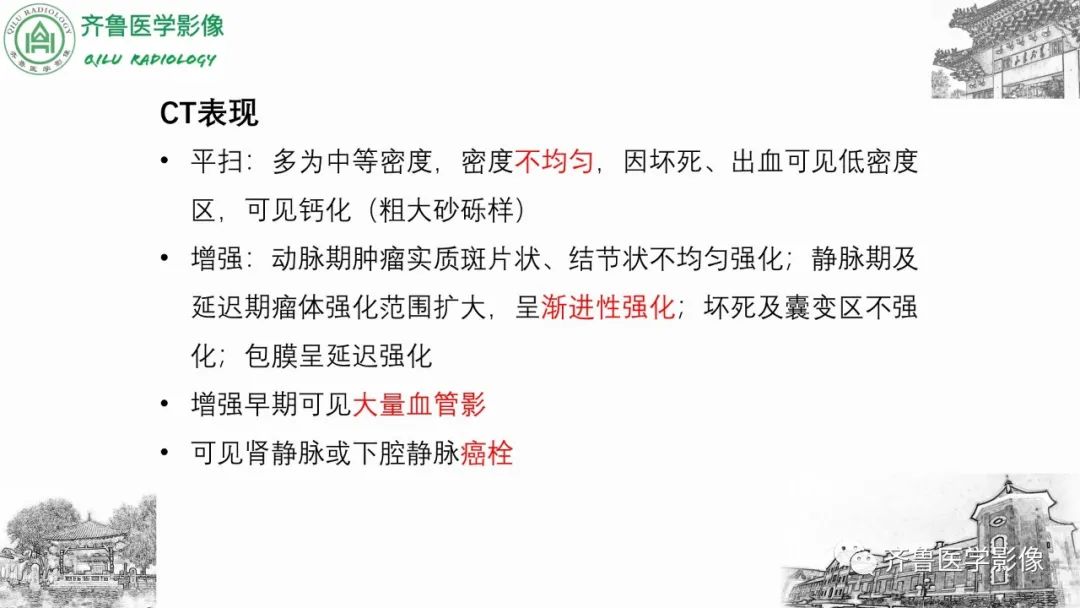 影像PPT - 【病例】肾上腺皮质腺癌2例CT及MR影像-25