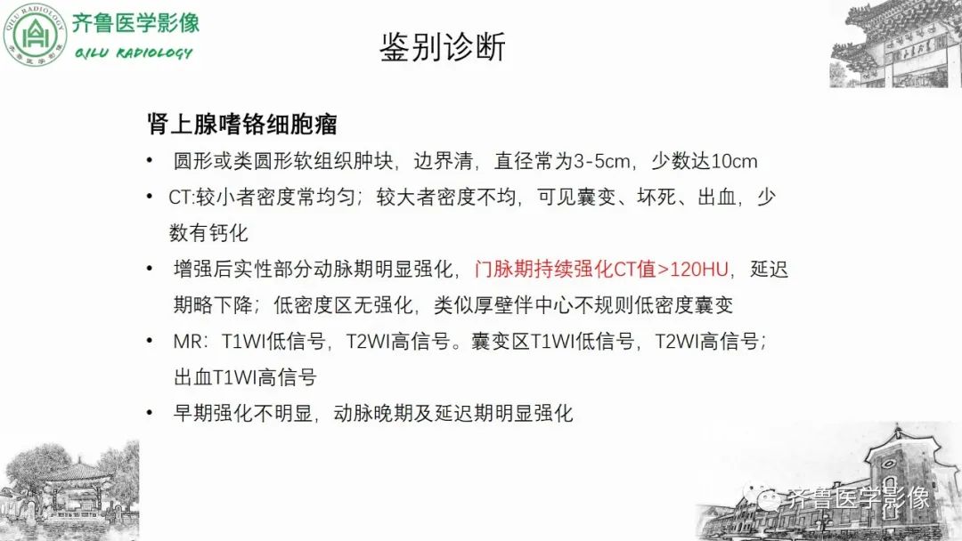 影像PPT - 【病例】肾上腺皮质腺癌2例CT及MR影像-29