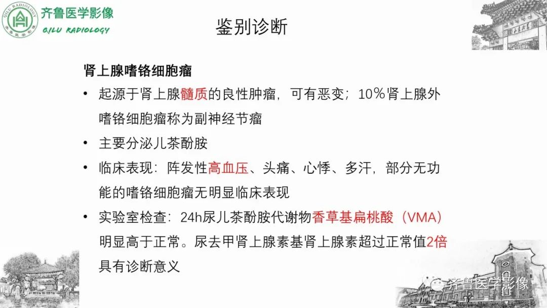 影像PPT - 【病例】肾上腺皮质腺癌2例CT及MR影像-28