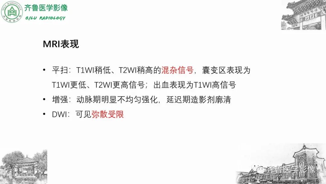 影像PPT - 【病例】肾上腺皮质腺癌2例CT及MR影像-27