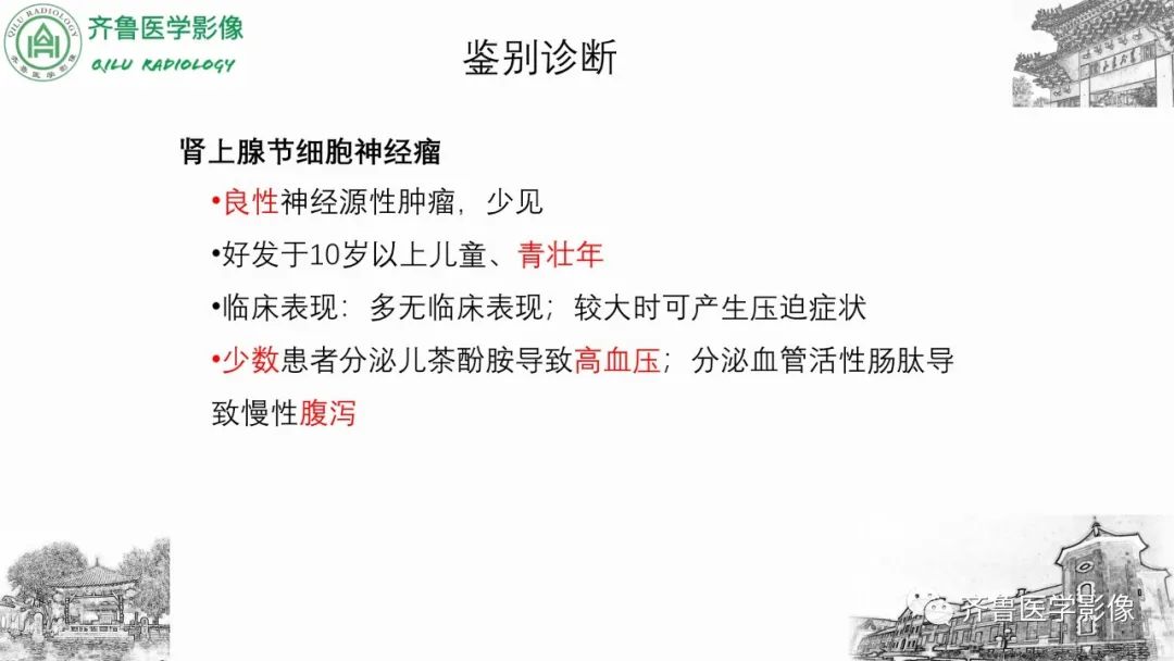 影像PPT - 【病例】肾上腺皮质腺癌2例CT及MR影像-35