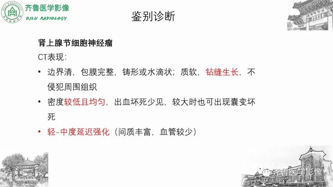 影像PPT - 【病例】肾上腺皮质腺癌2例CT及MR影像-36