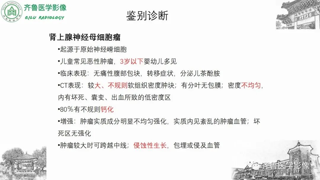 影像PPT - 【病例】肾上腺皮质腺癌2例CT及MR影像-40