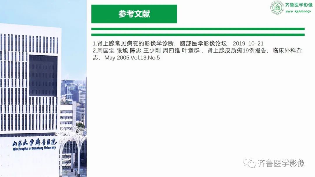影像PPT - 【病例】肾上腺皮质腺癌2例CT及MR影像-41