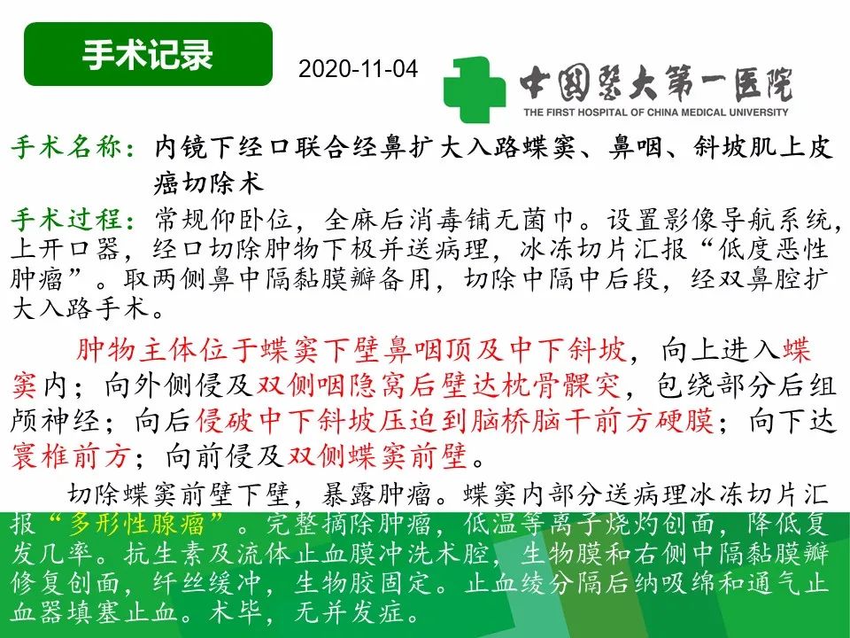 影像PPT - 【病例】鼻咽部肌上皮癌1例CT及MR影像-8