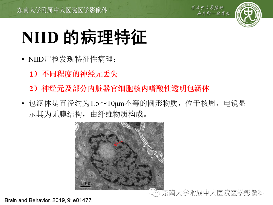 影像PPT - 【PPT】神经元核内包涵体病（NIID）的影像学诊断-8